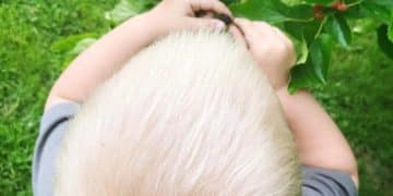 Long-Term Effects of Hair Loss Prevention Products: What to Expect After 5 Years - Cover Image