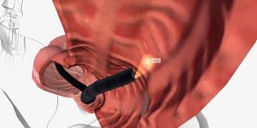 Understanding Penile Implants: Types, Benefits, and Considerations - Cover Image