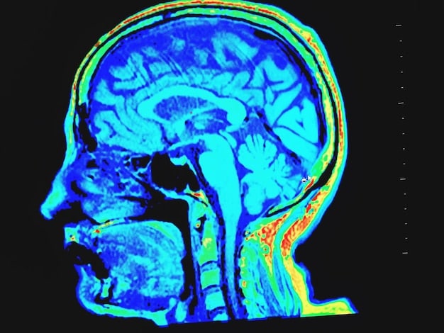 A brain scan graphic highlighting the areas of the brain associated with stress reduction and improved focus, with captions indicating how mindfulness and meditation impact these areas. This visual represents the scientific basis for the benefits.