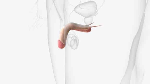 The Latest Research on Peyronie’s Disease: Treatment and Outcomes