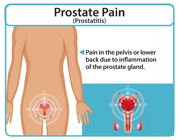 A diagram illustrating the male pelvic region, clearly showing the location of the prostate gland in relation to the bladder, rectum, and urethra. The image is labeled with anatomical terms, highlighting the prostate's role in urinary and reproductive functions and emphasizing 